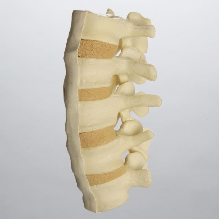 Spine, Lumbar, L1-L5, Anterior and Posterior Ligaments, Foam Cortical