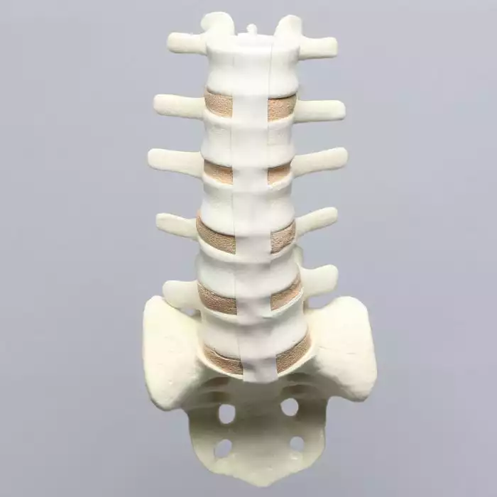 Spine, Lumbar, L1-Sacrum with Tan Discs, Solid Foam
