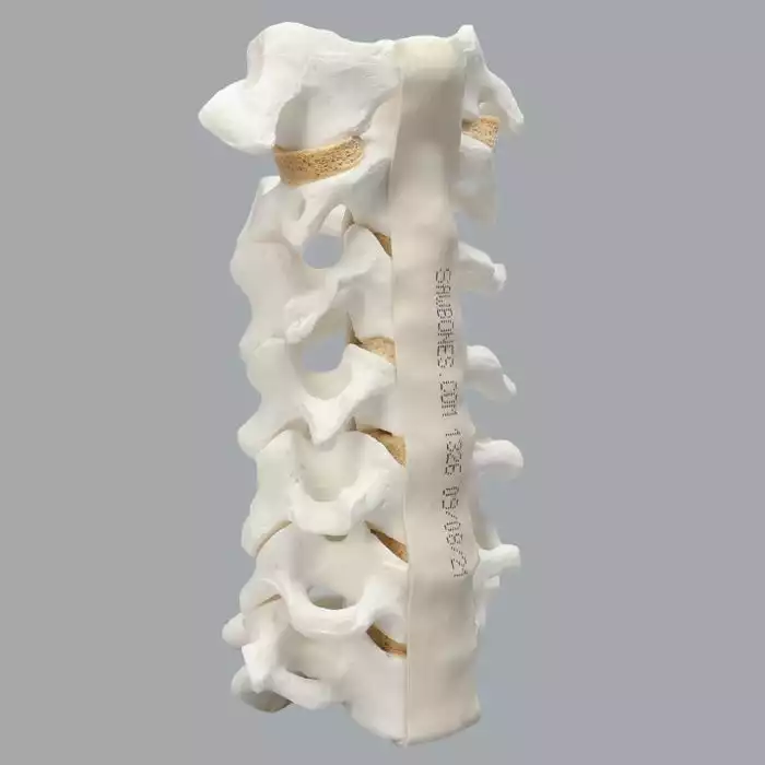 Spine, Cervical, Anterior and Posterior Ligaments, Solid Foam