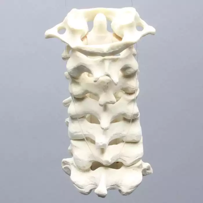 Spine, Cervical with Posterior Ligament, Solid Foam