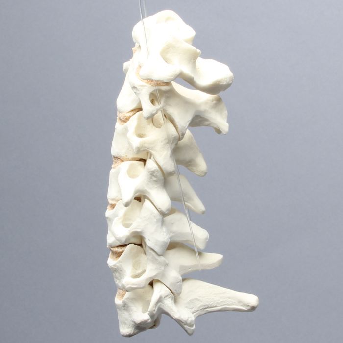 Spine, Cervical with Posterior Ligament, Solid Foam