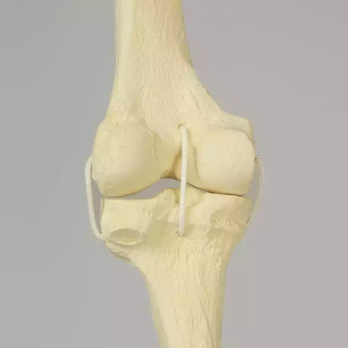 Knee with Three Non-Stretch Ligaments, Full Length