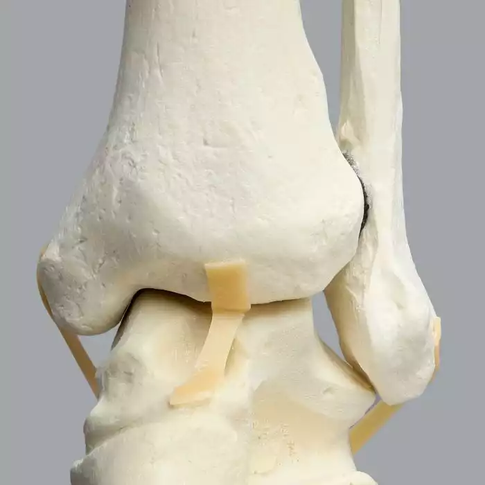 Foot and Ankle, Foam Cortical, Left