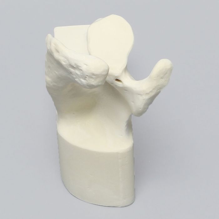 Scapula with Hollow Vise Attachment, Foam Cortical, Left