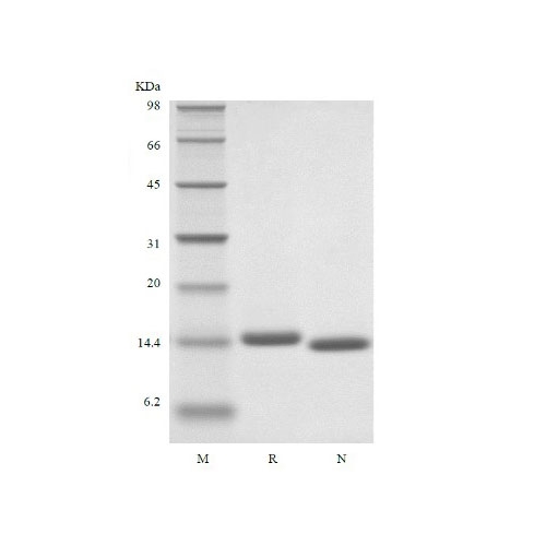 Recombinant Human Interleukin IL-2 / 면역세포 증식용 Cytoikine