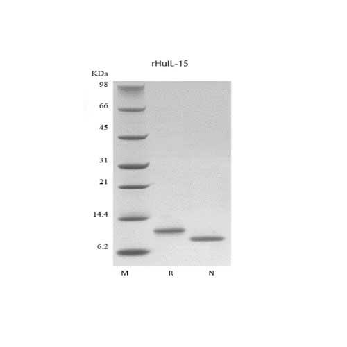 IL-15, Recombinant Human Interleukin/ 면역세포 증식용 Cytoikine