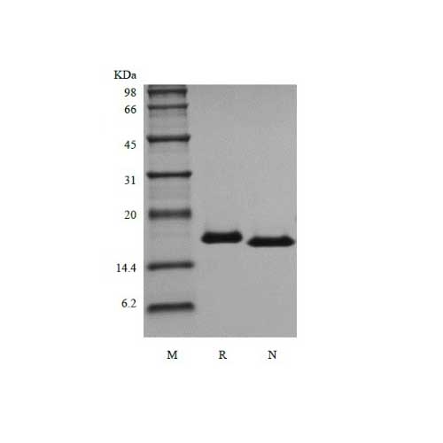 IL-21, Recombinant Human Interleukin/ 면역세포 증식용 Cytoikine